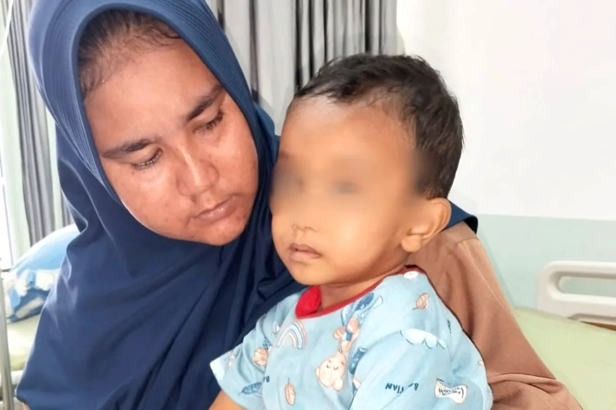 Kisah Bocah 3 Tahun di Aceh Selatan Alami Bocor Jantung, Orangtua Berharap Uluran Tangan untuk Biaya Operasi