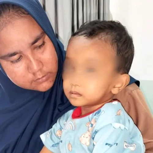 Kisah Bocah 3 Tahun di Aceh Selatan Alami Bocor Jantung, Orangtua Berharap Uluran Tangan untuk Biaya Operasi